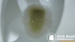 Diarrhea Toilet Clog