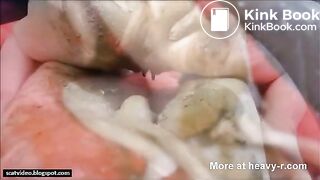 Shitting And Pissing With Speculum In Ass