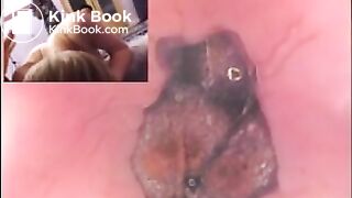 Three_russian_girl_in_anal_buttcam