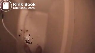 Shit running down the legs