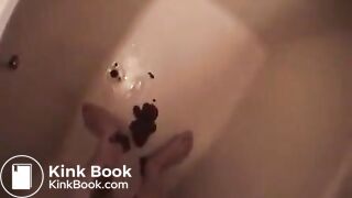Shit running down the legs
