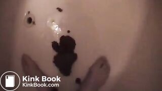Shit running down the legs