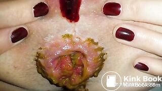 Morning Shit During Menstruation