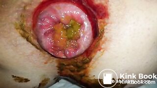 Morning Shit During Menstruation