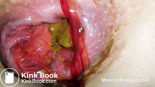 Morning Shit During Menstruation