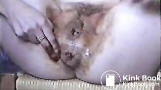 Extrem Anal-Fisting (Excellent)mpg