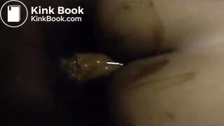 2014 anal