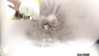 Asshole View 1