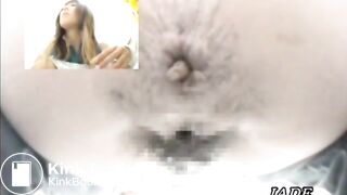 Asshole View 1