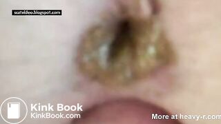 Liquid Shit Anal Fuck