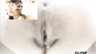 Asshole View 2