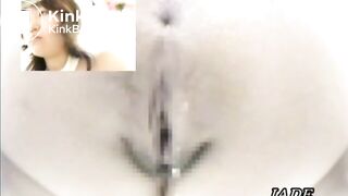Asshole View 2