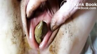 Poop In Vagina