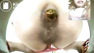 constipation