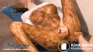 More of very rare fistinchen