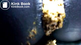 Black teen shitting close up