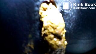 Black teen shitting close up