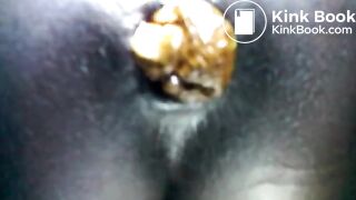 Black teen shitting close up