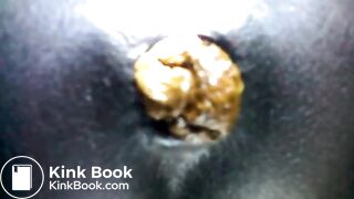 Black teen shitting close up