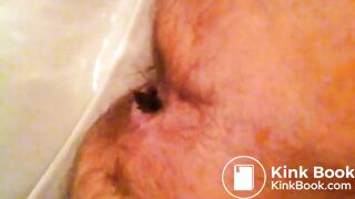 Scat toilet
