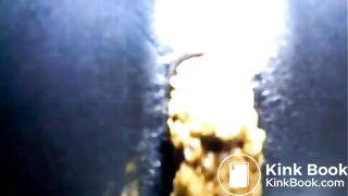 Black teen shitting close up