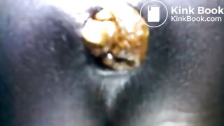 Black teen shitting close up