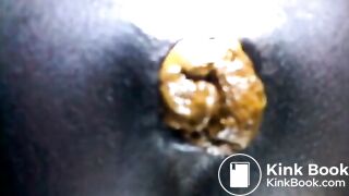 Black teen shitting close up