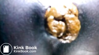 Black teen shitting close up