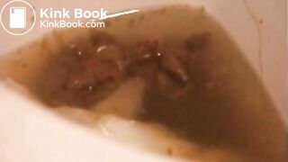 02 Exploding poop