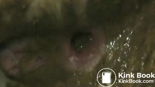 Teen Girl Shitting In Her Pantyhose