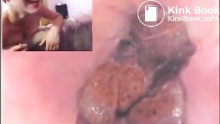 Three russian girl in anal buttcam