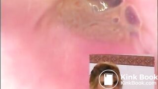 Three russian girl in anal buttcam