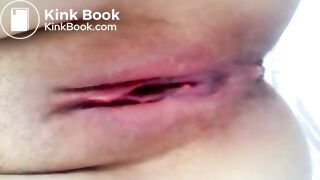 Close Up Shitting Anus