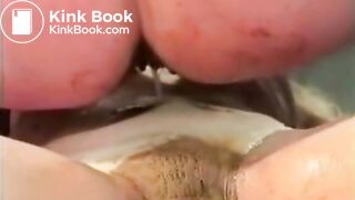 Pulling Shitty Beads From Pussy