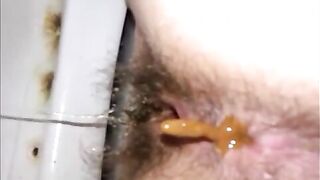 52 Pooping 52
