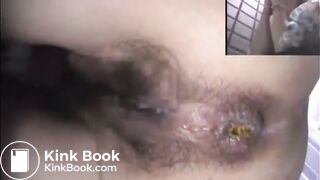Asshole View 15