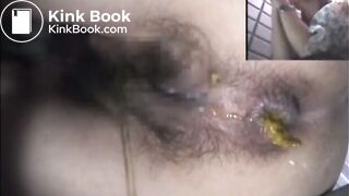 Asshole View 15
