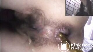 Asshole View 15