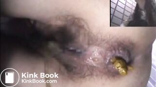Asshole View 15