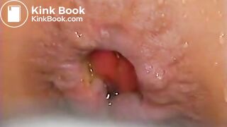 Japanese With Prolapsed Poop Shoot