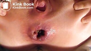 Anal Fucking In Ass That Needs To Shit Badly