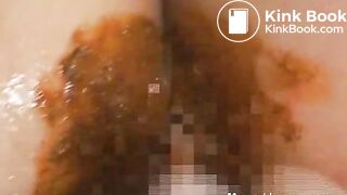 Asian Girls With Sudden Diarrhea