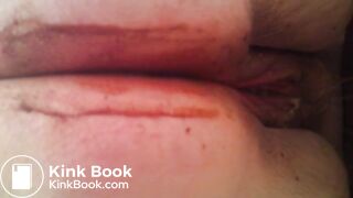 MOV_0581