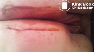 MOV_0581