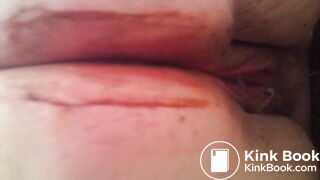 MOV_0581