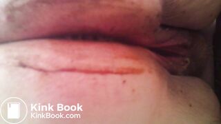 MOV_0581