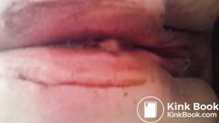 MOV_0581