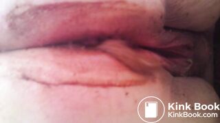 MOV_0581