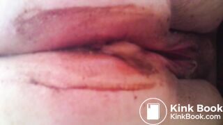 MOV_0581