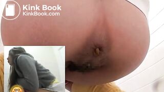 Asian Athlete Relief - The Shits 3